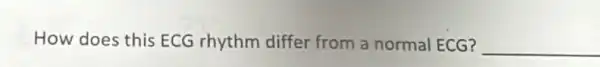 How does this ECG rhythm differ from a normal ECG? __